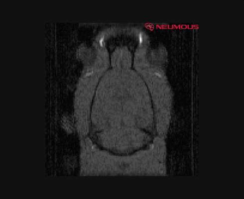 NEUMOUS BBB Opening brain imaging
