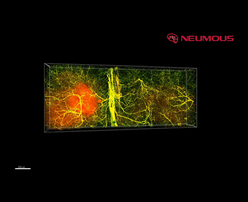 NEUMOUS Targeted Drug Delivery brain visualization